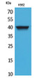 Western blot analysis of K562 cells using CXCR-3 Polyclonal Antibody.. Secondary antibody was diluted at 1:20000