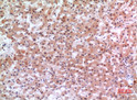 Immunohistochemical analysis of paraffin-embedded human-liver, antibody was diluted at 1:100