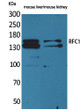 Western blot analysis of mouse liver, mouse kidney cells using RFC1 Polyclonal Antibody.. Secondary antibody was diluted at 1:20000 cells nucleus extracted by Minute TM Cytoplasmic and Nuclear Fractionation kit (SC-003, Inventbiotech, MN, USA).