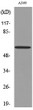 Western blot analysis of extracts from A549 cells, using K8 (Ab-483) Antibody.