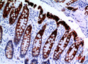 Immunohistochemical analysis of paraffin-embedded human-colon, antibody was diluted at 1:100