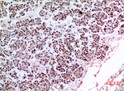 Immunohistochemical analysis of paraffin-embedded human-pancreas, antibody was diluted at 1:100