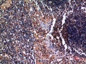 Immunohistochemical analysis of paraffin-embedded human-lymph-gland, antibody was diluted at 1:100