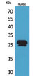 Western blot analysis of HuvEc cells using CacyBP Polyclonal Antibody.. Secondary antibody was diluted at 1:20000 Western blot analysis of HuvEc cells using CacyBP Polyclonal Antibody.. Secondary antibody was diluted at 1:20000