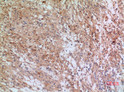 Immunohistochemical analysis of paraffin-embedded human-brain, antibody was diluted at 1:100