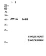 Western blot analysis of (STJ96773wb4147442094 lysis using INHBB Antibody antibody. Antibody was diluted at 1:2000. Secondary antibody was diluted at 1:20000