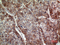 Immunohistochemical analysis of paraffin-embedded human-lung, antibody was diluted at 1:100