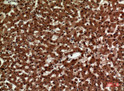 Immunohistochemical analysis of paraffin-embedded human-liver, antibody was diluted at 1:100
