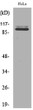 Western blot analysis of lysate from HeLa cells, using MCM6 Antibody. STJ96819