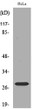 Western blot analysis of lysate from HeLa cells, using SNRPN Antibody. STJ96822