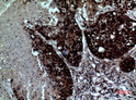 Immunohistochemical analysis of paraffin-embedded human-lung, antibody was diluted at 1:100 Immunohistochemical analysis of paraffin-embedded human-lung, antibody was diluted at 1:100