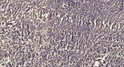 Immunohistochemical analysis of paraffin-embedded human meningioma. 1, Antibody was diluted at 1:200 (4° overnight). 2, STJ96826