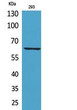 Western Blot analysis of 293 cells using IL-18R Polyclonal Antibody. Secondary antibody was diluted STJ96837