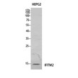 Western blot analysis of HeLa cells using IFITM2 polyclonal antibody. Antibody was diluted at 1:1000. Secondary STJ96897