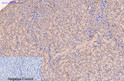 Immunohistochemical analysis of paraffin-embedded Mouse-kidney tissue. 1, CD5 monoclonal antibody (10G8) was diluted at 1:200 (4°C, overnight). 2, Sodium citrate pH 6.0 was used for antibody retrieval (>98°C, 20min). 3, Secondary antibody was diluted at 1:200 (room tempeRature, 30min). Negative control was used by secondary antibody only.