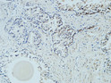 Immunohistochemical analysis of paraffin-embedded Human Prostate. 1, Antibody was diluted at 1:100 (4°C overnight). 2, High-pressure and temperature EDTA, pH8.0 was used for antigen retrieval. 3, Secondary antibody was diluted at 1:200 (room temperature, 30min).