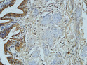Immunohistochemical analysis of paraffin-embedded Human gallbladder. 1, Antibody was diluted at 1:100 (4°C overnight). 2, High-pressure and temperature EDTA, pH8.0 was used for antigen retrieval. 3, Secondary antibody was diluted at 1:200 (room temperature, 30min).