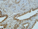 Immunohistochemical analysis of paraffin-embedded Human gallbladder. 1, Antibody was diluted at 1:100 (4°C overnight). 2, High-pressure and temperature EDTA, pH8.0 was used for antigen retrieval. 3, Secondary antibody was diluted at 1:200 (room temperature, 30min).