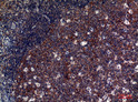 Immunohistochemical analysis of paraffin-embedded human tonsils, antibody was diluted at 1:100 STJ97282