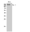Western Blot analysis of HeLa cells using Ron α Polyclonal Antibody. Secondary antibody was diluted STJ97304