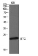 Western blot analysis of KB cells using probetalin polyclonal antibody. Secondary antibody was STJ97337