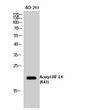 Western blot analysis of AD-293 cells using Acetyl-NF-E4 (K43) Polyclonal Antibody. Secondary antibody was diluted at 1:20000