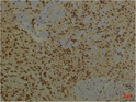 Immunohistochemical analysis of paraffin-embedded Mouse BrainTissue using PI3 Kinase P85 Alpha Mouse mAb diluted at 1:200.