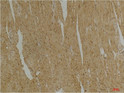 Immunohistochemical analysis of paraffin-embedded Mouse Heart Tissue using DesminMouse mAb diluted at 1:200.