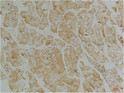 Immunohistochemical analysis of paraffin-embedded Mouse Skeletal Muscle Tissue using Desmin (mAb diluted at 1:200.