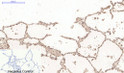 Immunohistochemical analysis of paraffin-embedded Human-lung tissue. 1, Desmin monoclonal antibody (1B12) was diluted at 1:200 (4°C, overnight). 2, Sodium citrate pH 6.0 was used for antibody retrieval (>98°C, 20min). 3, Secondary antibody was diluted at 1:200 (room tempeRature, 30min). Negative control was used by secondary antibody only.