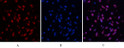 Immunofluorescence analysis of human-uterus tissue. 1, Desmin monoclonal antibody (1B12) (red) was diluted at 1:200 (4°C, overnight). 2, Cy3 labled Secondary antibody was diluted at 1:300 (room temperature, 50min).3, Picture B: DAPI (blue) 10min. Picture A:Target. Picture B: DAPI. Picture C: merge of A+B