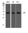 Western blot analysis of HELA KB PC-3 using p38 Polyclonal Antibody. Antibody was diluted at 1:1000. Secondary antibody was diluted at 1:20000
