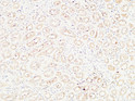 Immunohistochemical analysis of paraffin-embedded Human kidney. 1, Antibody was diluted at 1:100 (4°C overnight). 2, High-pressure and temperature EDTA, pH8.0 was used for antigen retrieval. 3, Secondary antibody was diluted at 1:200 (room temperature, 30min).