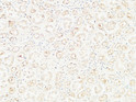Immunohistochemical analysis of paraffin-embedded Human kidney. 1, Antibody was diluted at 1:100 (4°C overnight). 2, High-pressure and temperature EDTA, pH8.0 was used for antigen retrieval. 3, Secondary antibody was diluted at 1:200 (room temperature, 30min).
