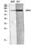 Western blot analysis of 293T 3T3 lysis using DPP4 antibody. Antibody was diluted at 1:500. Secondary antibody was diluted at 1:20000