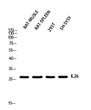 Western blot analysis of RAT-MUSLE rat spleen 293T SH-SY5Y using IL26 antibody. Antibody was diluted at 1:2000. Secondary antibody was diluted at 1:20000