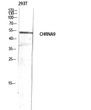 Western blot analysis of 293T lysis using CHRNA9 antibody. Antibody was diluted at 1:500. Secondary antibody was diluted at 1:20000