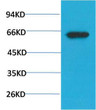 Western blot analysis of PC3 cell lysate using Phospho-Akt Ser473 Mouse mAb diluted at 1:1000. STJ97727