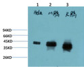 Western blot analysis of 1) Hela Cell Lysate, 2) Mouse Brain Tissue Lysate, 3) Rat Brain Tissue Lysate using ERK1/2 Mouse mAb diluted at 1:2000.