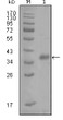 Western blot analysis using A-FABP monoclonal antibody against truncated Trx-FABP4 recombinant protein (1). STJ97815