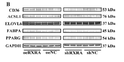 Western Blot (WB): A Novel Role in Duck Myoblasts: The Transcription Factor Retinoid X Receptor Alpha (RXRA) Inhibits STJ97815