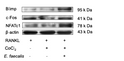 Effect of Enterococcus faecalis on osteoclastogenesis under cobalt-mimicked hypoxia in vitro MICROBIAL PATHOGENESIS STJ97865