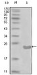 Western blot analysis using CD10 monoclonal antibody against truncated CD10-His recombinant protein (1).