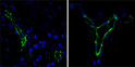 Immunofluorescence analysis of paraffin-embedded human lung cancer (left) and breast cancer (right) cells using CD31 monoclonal antibody (green). Blue: DRAQ5 fluorescent DNA dye.