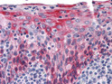 Immunohistochemistry analysis of paraffin-embedded human Tonsil tissues with AEC staining using Cytokeratin 15 monoclonal antibody.