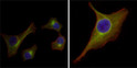 Immunofluorescence analysis of HepG2 (left) and PACN-1 (right) cells using Cytokeratin 15 monoclonal antibody (green). Red: Actin filaments have been labeled with DY-554 phalloidin. Blue: DRAQ5 fluorescent DNA dye.
