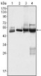 Western blot analysis using Cytokeratin 7 monoclonal antibody against HeLa (1) , MCF-7 (2) , A431 (3) and A549 (4) cell lysate.