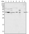Western blot analysis using ERK 2 monoclonal antibody against HeLa (1) , NIH/3T3 (2) , MCF-7 (3) , HEK293 (4) , Jurkat (5) , A549 (6) , NTERA-2 (7) and SMMC-7721 (8) cell lysate. Western blot analysis using ERK 2 monoclonal antibody against HeLa (1) , NIH/3T3 (2) , MCF-7 (3) , HEK293 (4) , Jurkat (5) , A549 (6) , NTERA-2 (7) and SMMC-7721 (8) cell lysate.