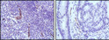 Immunohistochemistry analysis of paraffin-embedded human lymph node (left) and colon cancer (right) tissues with DAB staining using NOS3 monoclonal antibody.