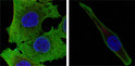 Confocal immunofluorescence analysis of PANC-1 (left) and SKBR-3 (right) cells using SOD-1 monoclonal antibody (green). Red: Actin filaments have been labeled with DY-554 phalloidin. Blue: DRAQ5 fluorescent DNA dye.